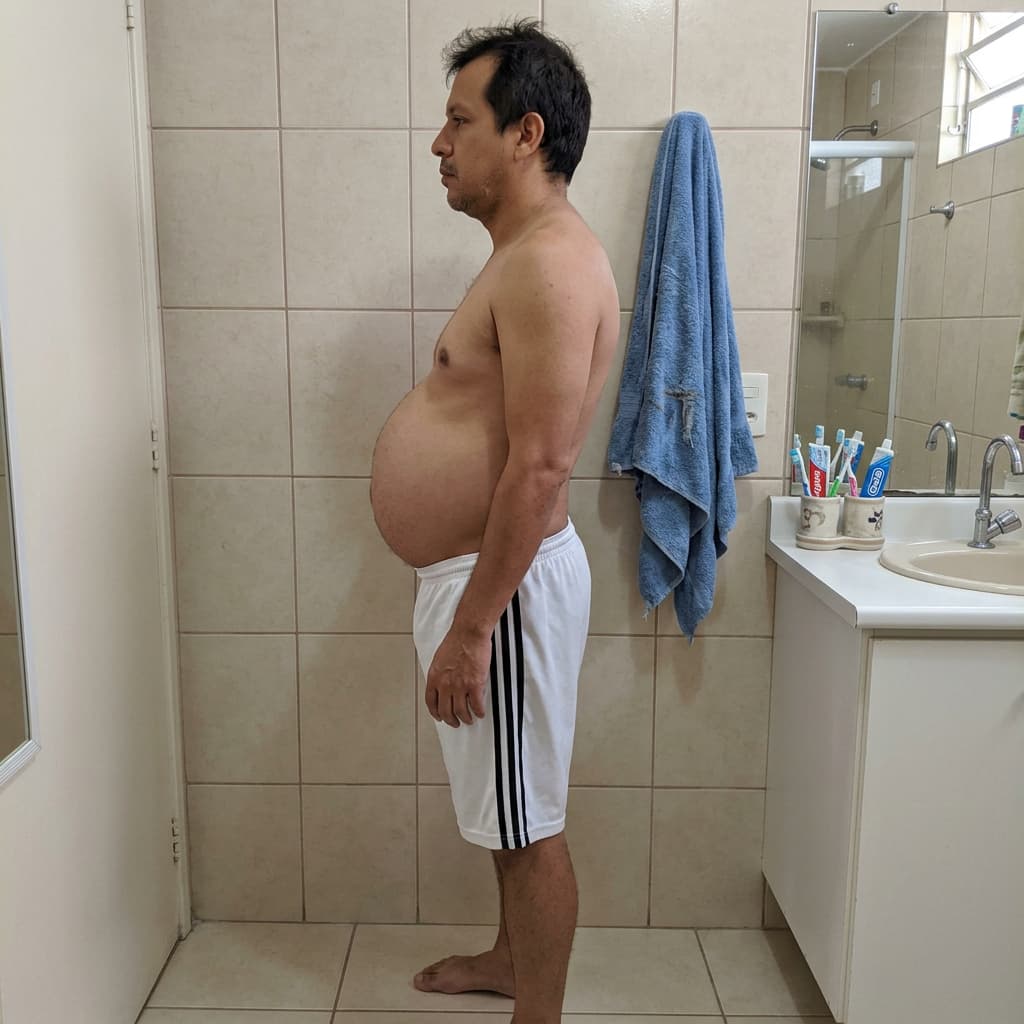 Antes - Testimonio 2